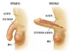 引起男人阳痿的原因有哪些