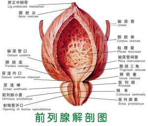 前列腺炎怎么形成的？