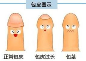 小孩包皮过长有什么危害？
