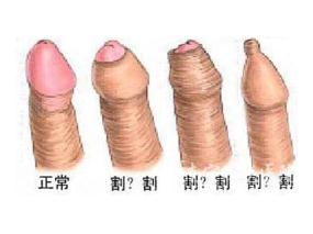 小孩包皮过长有什么危害？